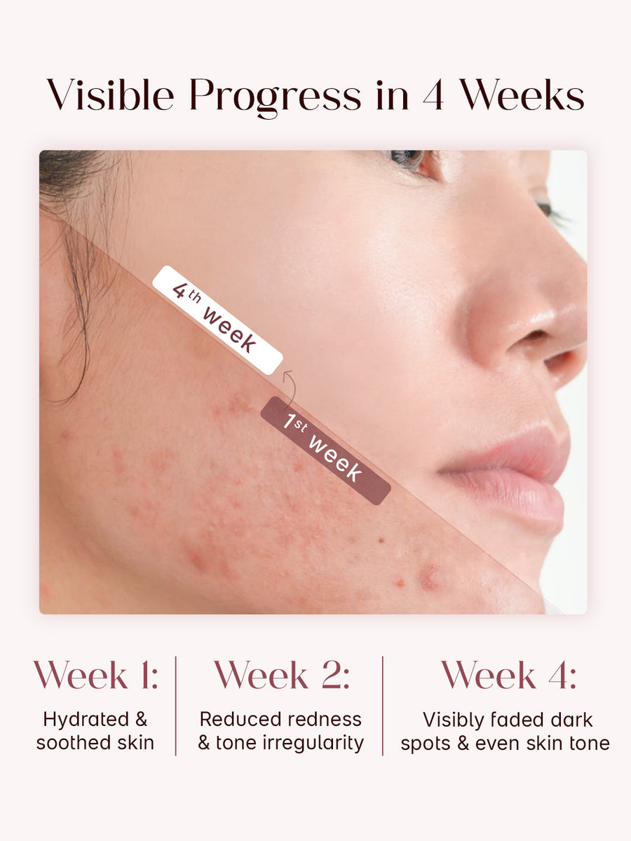 SEOULSKIN RED SERUM (NIACINAMIDE 5 +TXA 3)