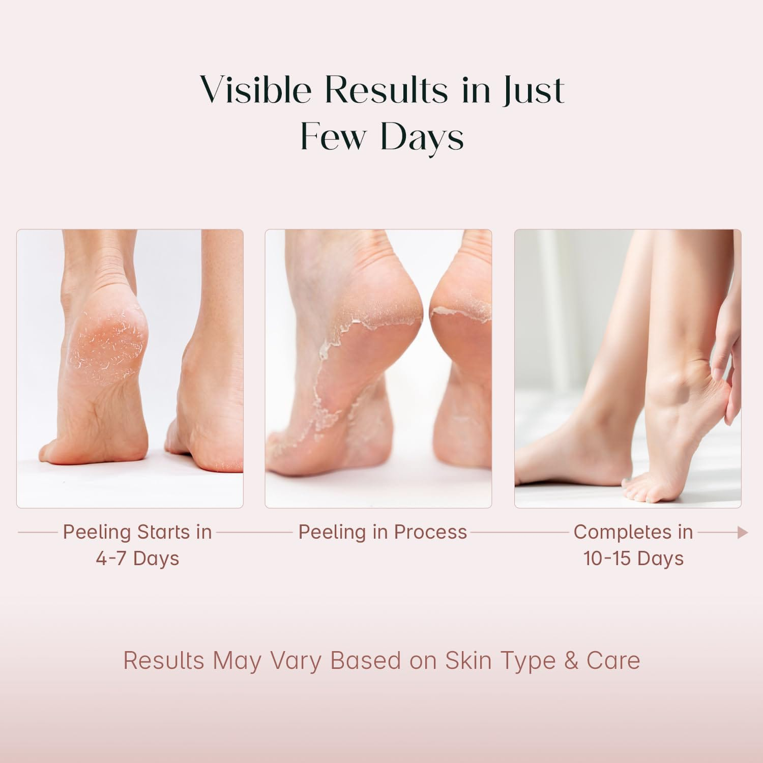 SeoulSkin Glycolic Acid Foot Peeling Mask (1 Pair)