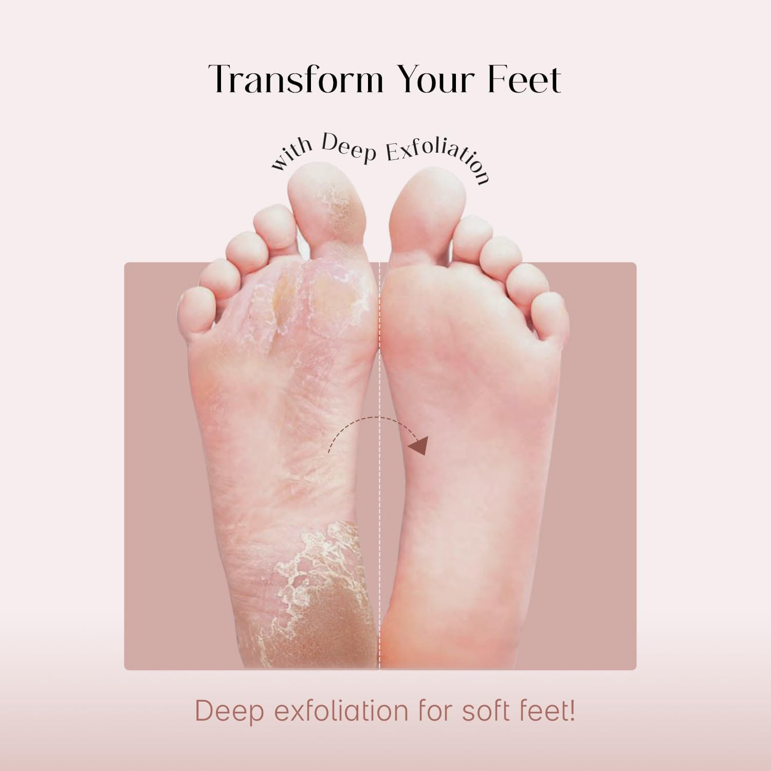 SeoulSkin Glycolic Acid Foot Peeling Mask (1 Pair)